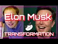 ELON MUSK transformation: Elon&#39;s then and now hair loss, hair transplant, before and after veneering