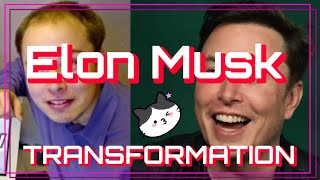 ELON MUSK transformation: Elon's then and now hair loss, hair transplant, before and after veneering
