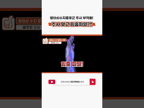 방아쇠수지증후군주사 부작용
