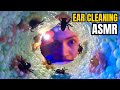 Asmrcleaning your ear so relax
