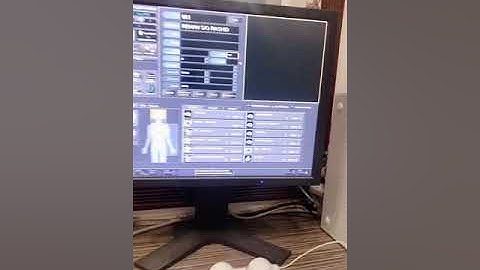 Ct scan control panel setup for scanning (part 2)