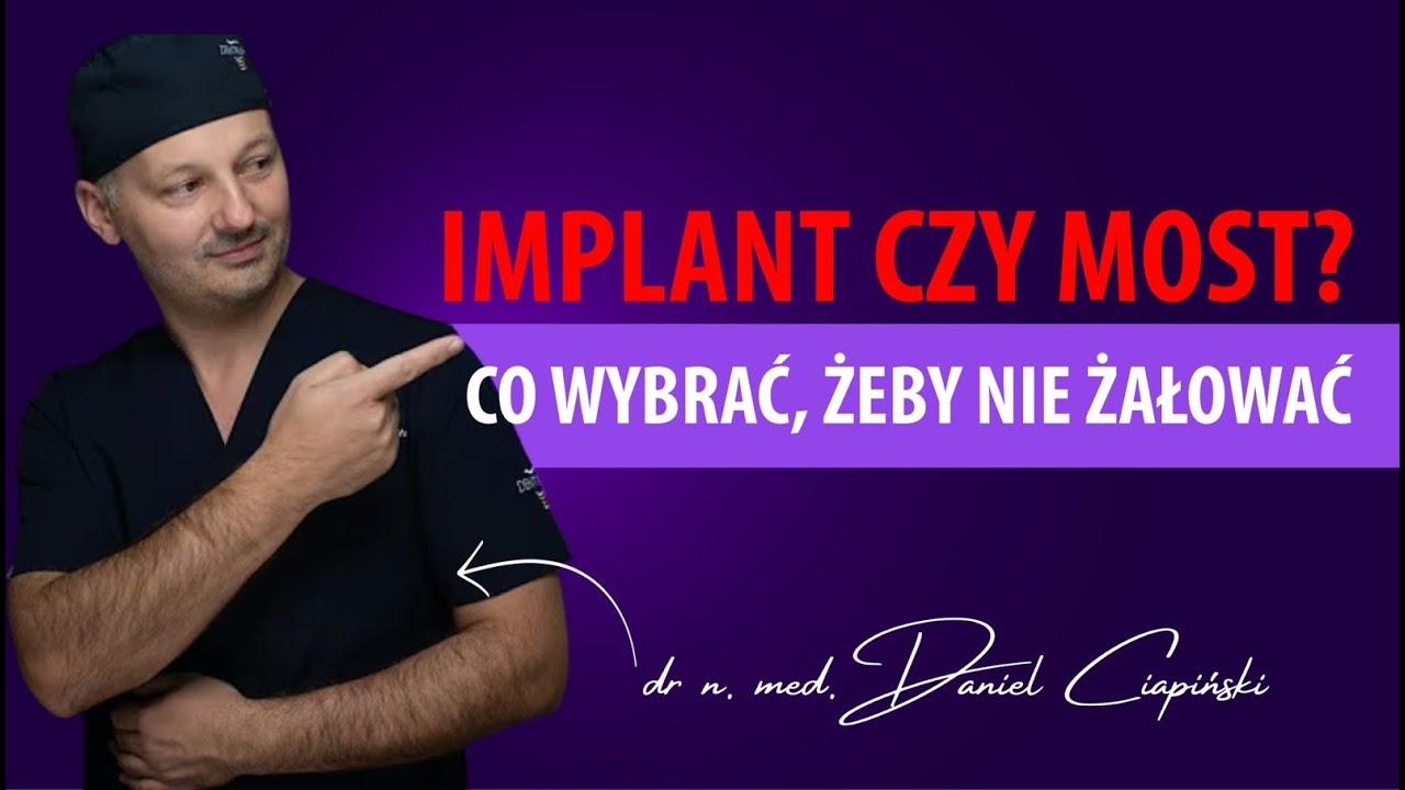 Implant czy most? Co wybrać?