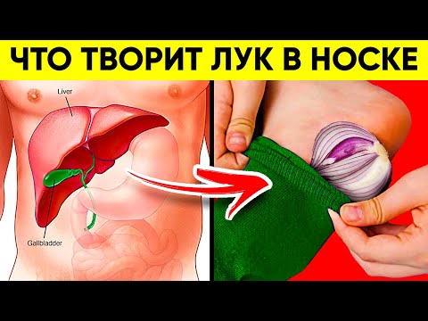ВОТ ЧТО ТВОРИТ ЛУК В НОСКАХ! (Реальная Польза и Вред Лука в Носках на Ночь)