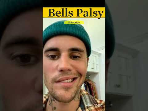 Bell's Palsy/Justin Bieber Bell's Palsy video/Shorts - YouTube