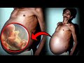 Mengejutkan!! Inilah Kondisi Kehamilan Paling Tidak Biasa Yang Ada Di Dunia