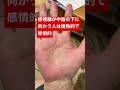 感情線が中指の下に向かう人は情熱的、熱しやすく冷めやすいタイプ