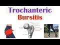 Trochanteric Bursitis (Greater Trochanteric Pain Syndrome) | Causes, Symptoms, Diagnosis, Treatment
