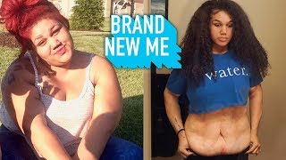 I Lost 200lbs But Felt Trapped In My Excess Skin | BRAND NEW ME