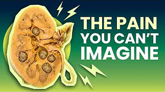 The Gritty Anatomy Inside Your Kidney
