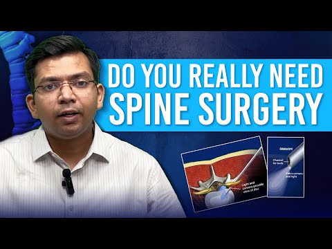 When is Spine Surgery Really Needed? - Dr. Achal Gupta Clinical Advice