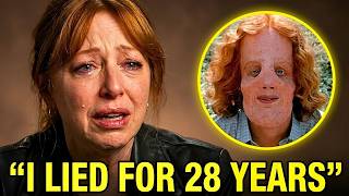 Before She Passed, Rocky Dennis’s Mom Finally Revealed Truth About Him And It’s Bad