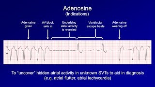 Antiarrhythmics (Lesson 6 - Digoxin, Adenosine, Atropine, Isoproterenol, and Ivabradine)