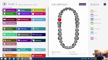 3D Printed Implant Analog Models with ExoCAD: Opening Screen