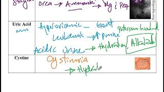 USMLE ACE Video 234: Kidney Stones: Types, Causes, Treatments, and Clinical Presentation