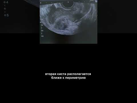 #узи #immanuelkantbalticfederaluniversity