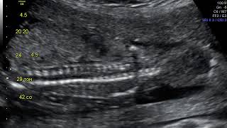 IMG 20171103 1 6