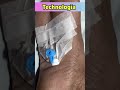 Technologia😇 ft Cannula Insertion #hospital #shorts #icu