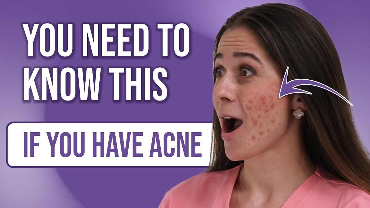 Why Your Acne Won’t Go Away | Causes, Types & Triggers Explained