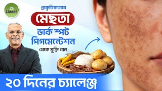 মছতর দগ ও তবকর কলচ ভব দর করন Scientifically Proven Natural Remedies For Glowing Skin