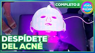 Do you have acne problems? We show you an innovative treatment 🧖🏻‍♀️✨ | Venga La Alegría