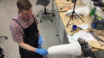 Transfemoral Cast Modification Part 1