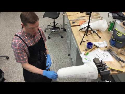 Transfemoral Cast Modification Part 1