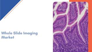 Whole Slide Imaging Market Overview, Demand Analysis Exactitude Consultancy Reports