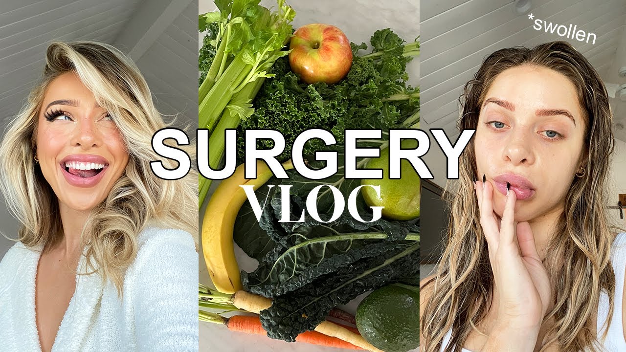 VLOG: Fixing my Smile, Gum Graft Surgery, Tips to Heal and Recover, Eating 30+ Fruits and Veggies