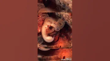 لا يصدقة عقل شاهد مراحل تطور الجنين داخل الرحم الى الولادة سبحان الله الخالق Shorts 