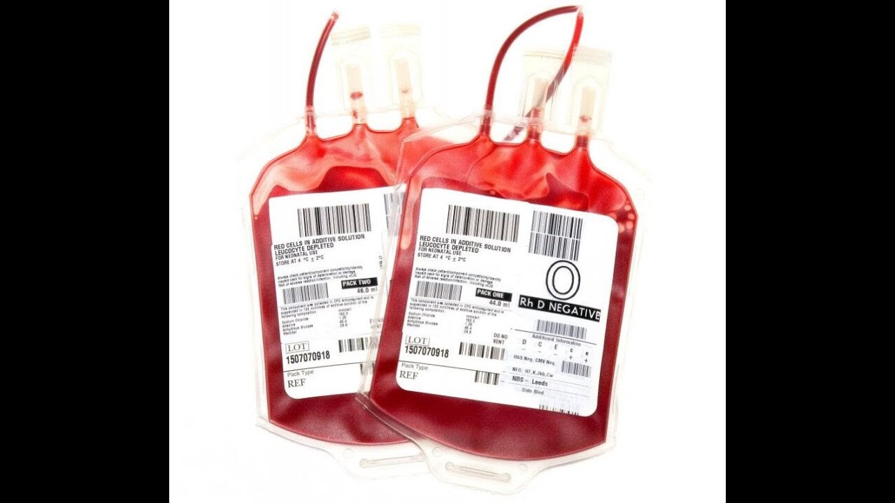 Indications for Washed Red Blood Cell Component Therapy