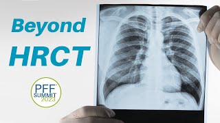 10 Beyond HRCT Full Session v2