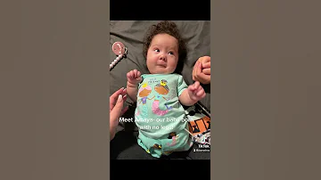 Meet Amaya The Baby Born Without Legs 