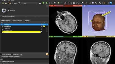 Transforming objects using Data module in 3D Slicer