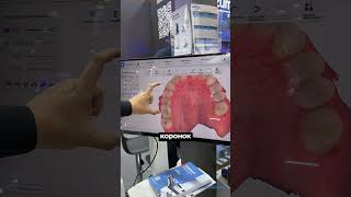 Интраоральный беспроводной 3D-сканер Aoralscan 3 Wireless NEO  #интраоральныйсканер