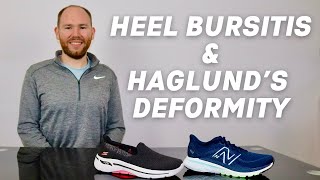 Best Shoes for Haglund's Deformity and Retrocalcaneal Bursitis | Shoes for Heel Bursitis