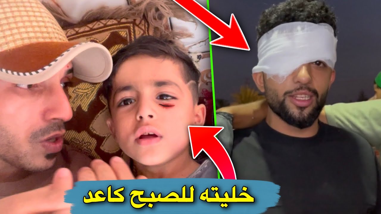 خليت يمان يخدم الزوار للصبح 😅 | صديقي حترك بعينه 🥲