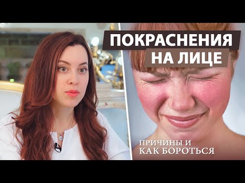 Видео: Почему краснеет лицо?