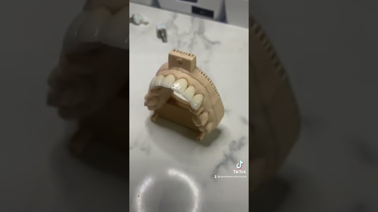 How ceramic veneers are made in our lab! 