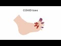 Appreciating potential complications of COVID-19