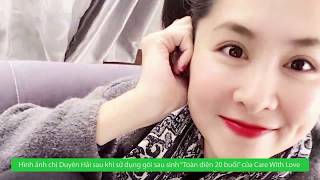 Care With Love và hành trình chinh phục khách hàng thứ 30.000