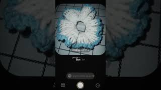 Rảnh Rảnh Làm Chơi Xg Thoái Hoá Cột Sống Lun