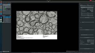 Using Segment Anything for Microscopy on Electron Microscopy Images from a Male Mouse