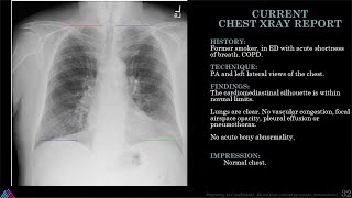 Dynamic Digital Radiography   For Pulmonary applications RSNA 2019