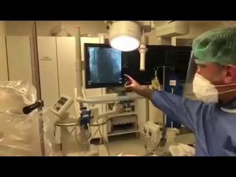 TAVİ YÖNTEMİYLE AORT KAPAK DEĞİŞİMİ