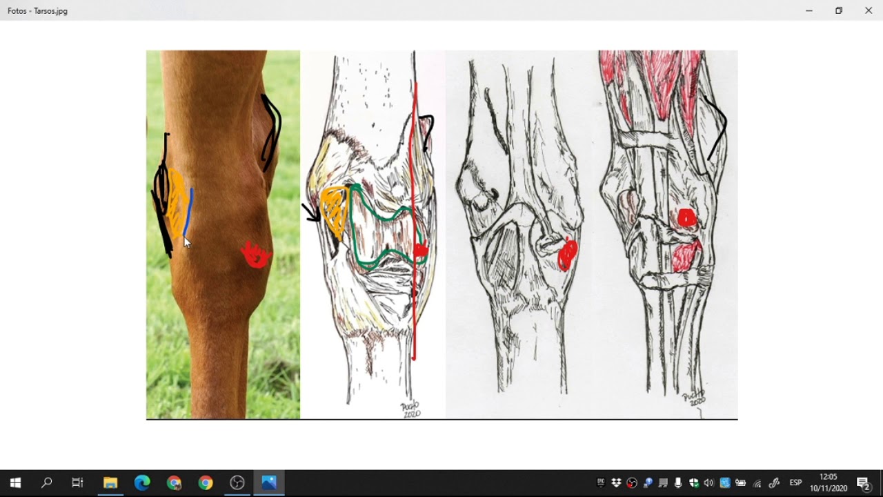 Tarso dorsal