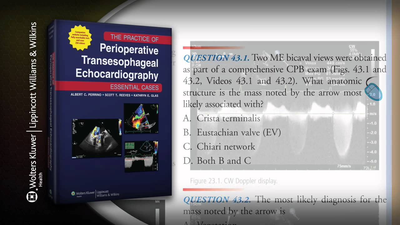 The Practice of Perioperative Transesophageal Echocardiography: Essential  Cases