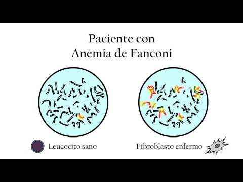 La Anemia de Fanconi - Diagnóstico genético