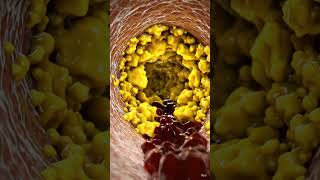 STOP Eating These! (Heart Warning) #healthhacks #ukwellness #fatloss #gym
