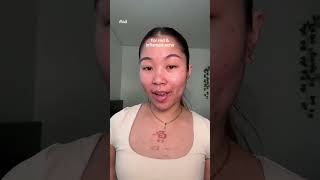 Product recs for acne that DON’T destroy your skin barrier #CeraVePartner  #DevelopedWithDerms