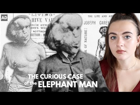 Video: Người voi Joseph Merrick: Chuyện đời